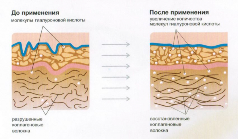 Для чего нужен коллаген организму, 7 полезных свойств